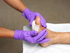 Podiatrists In Wound Care