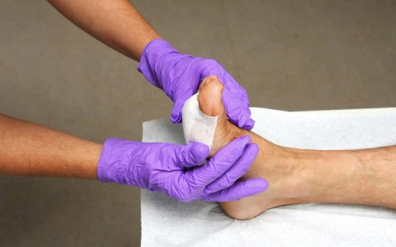 Podiatrists In Wound Care